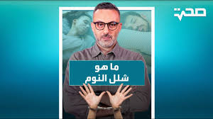 تقرير عن الجاثوم